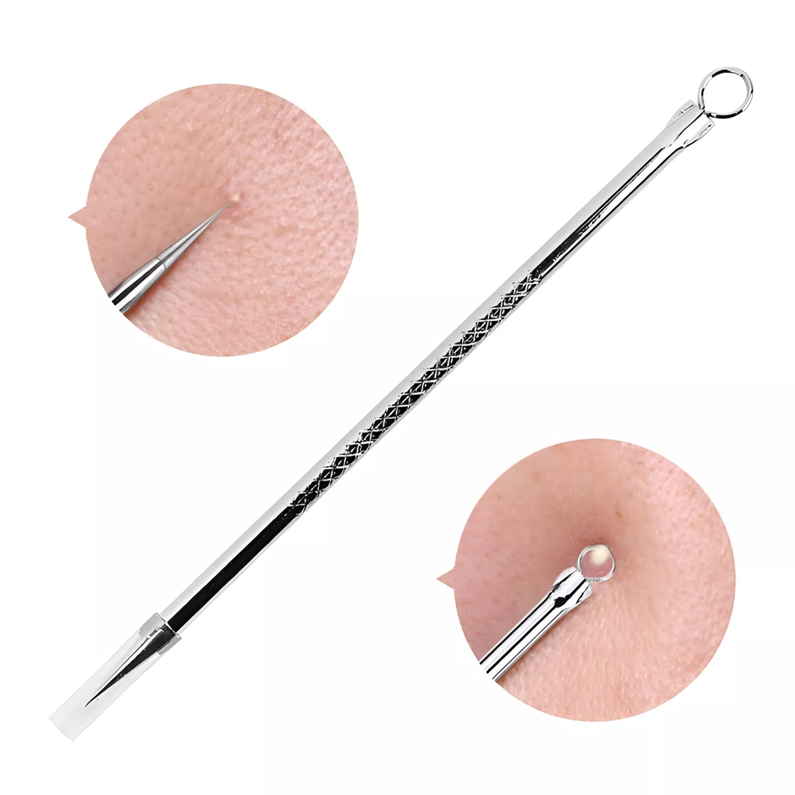 Blackhead & Acne Extractor Tool - Image 3