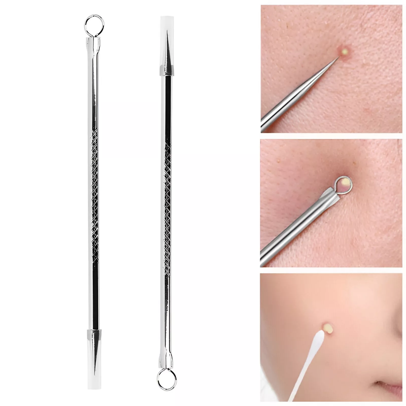 Blackhead & Acne Extractor Tool - Image 2