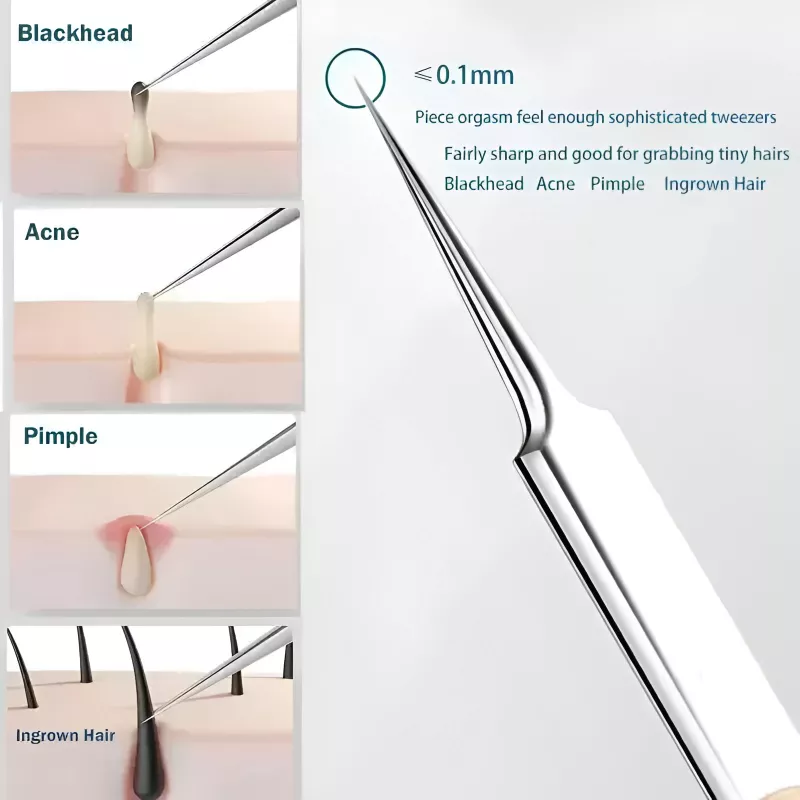 11-Piece Acne Needle & Blackhead Remover Set - Image 6