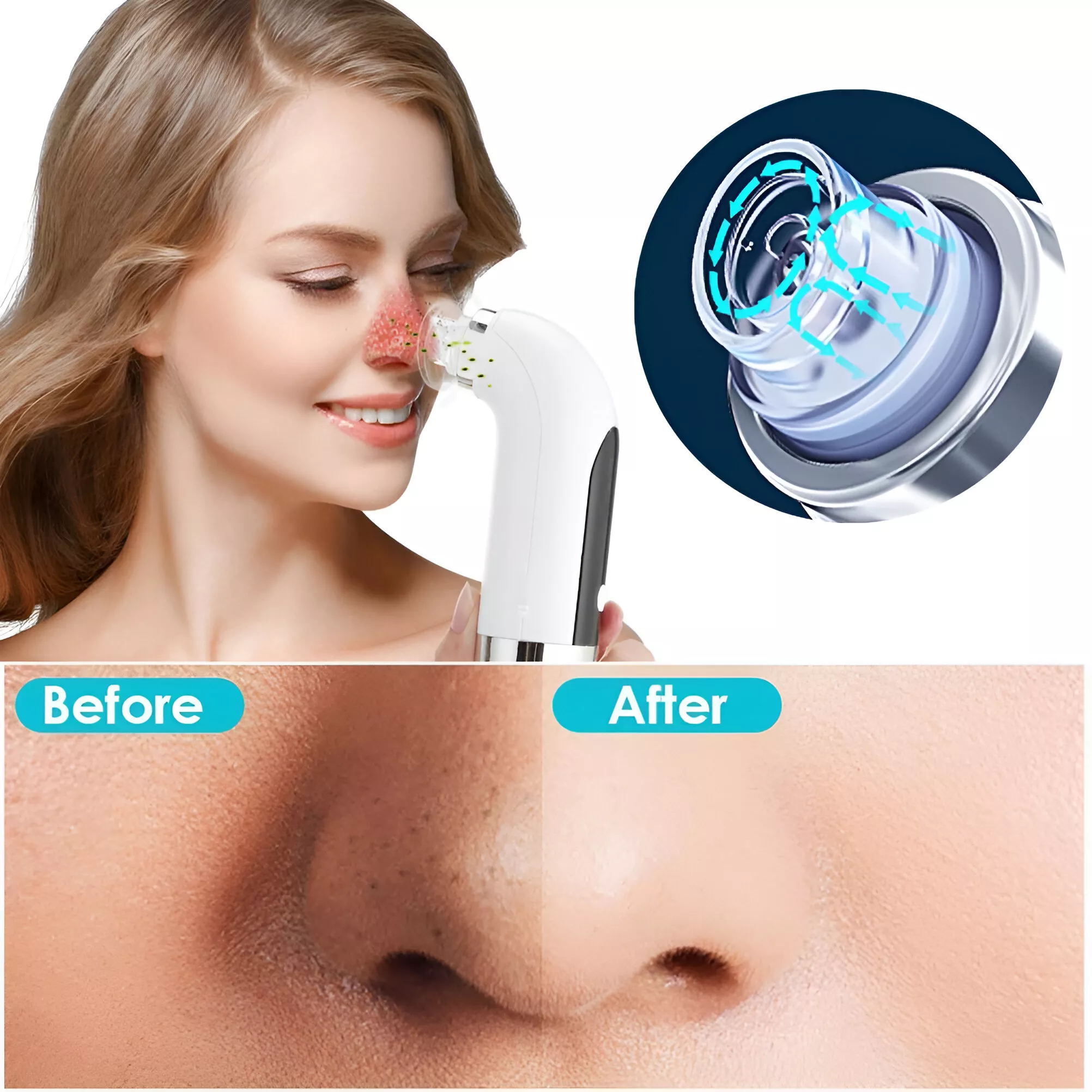 5-in-1 Blackhead Remover & Pore Vacuum Facial Cleansing Device - Image 4